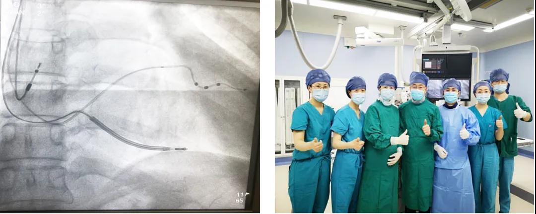 西安國際醫(yī)學中心醫(yī)院心臟內科首例心臟再同步治療除顫器（CRT-D）植入成功