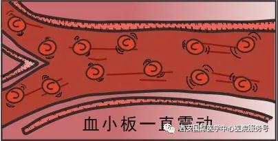 血小板是正常值的三倍？專家提醒小心血栓和出血！