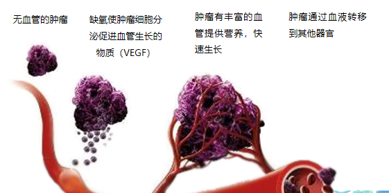 晚期腫瘤為什么會復(fù)發(fā)轉(zhuǎn)移？