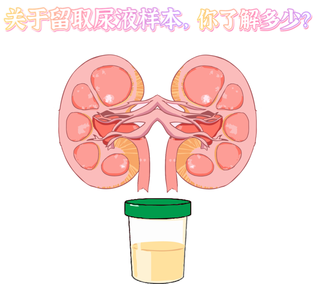 做尿檢，不得不說的注意事項！