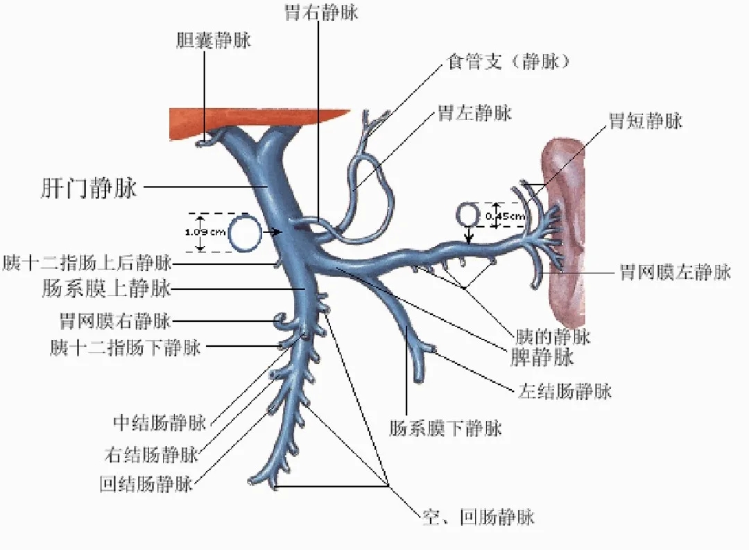 反復(fù)嘔血、黑便怎么辦？TIPS手術(shù)能解決