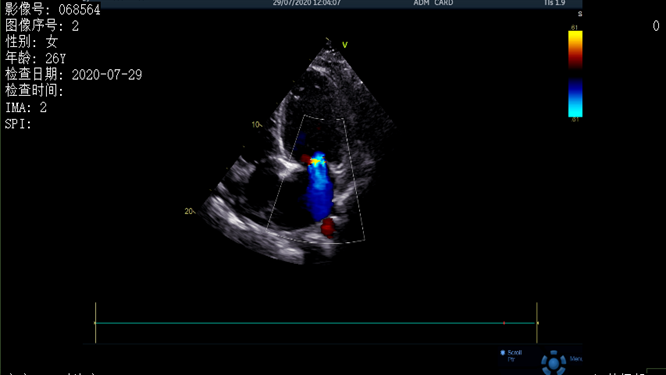 心電圖異常，心臟卻沒(méi)事，罪魁禍?zhǔn)资恰?>
				             </a>
                <div   id=