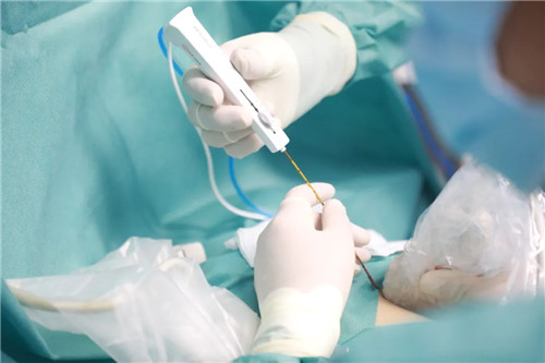 針尖上的絕絕子①｜從重慶到西安，23歲的姑娘只為了這件事……周曉東和他的超聲團隊