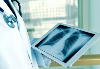 健康呼吸④體檢發(fā)現(xiàn)肺結(jié)節(jié)，我該怎么辦？