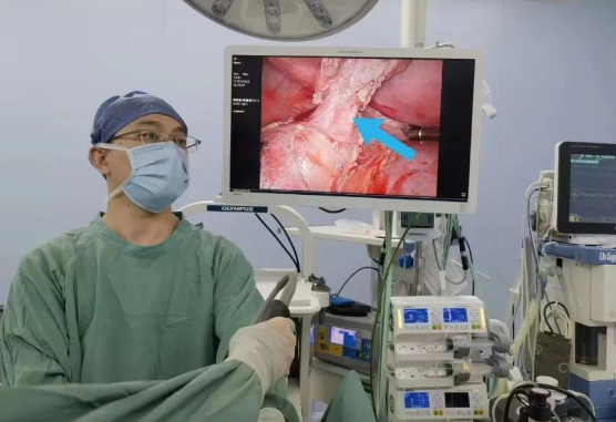 30歲小伙持續(xù)發(fā)燒咳嗽，原來是多長一塊肺......