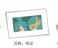 關(guān)愛身體健康，輕松檢查胃腸