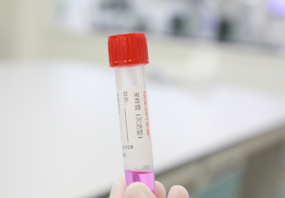 支原體感染檢測手段知多少？