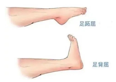 扭胯小連步、動感搖花手……“科目三”雖火，運動損傷也要防！