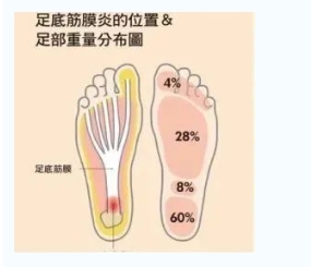 每年新生數(shù)百萬(wàn)足底筋膜炎患者！國(guó)際醫(yī)學(xué)專(zhuān)家提醒：跑步要選擇合適的鞋